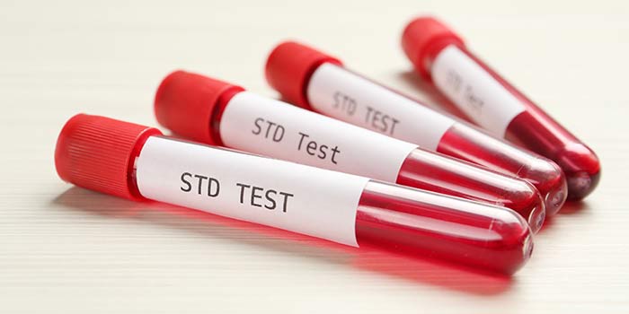 Expert STD Testing Clinic Near Me in Tyler TX