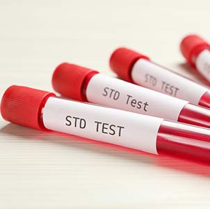 std-testing